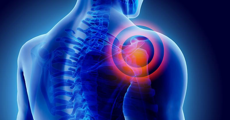 what-is-the-best-treatment-for-frozen-shoulder-miosuperhealth