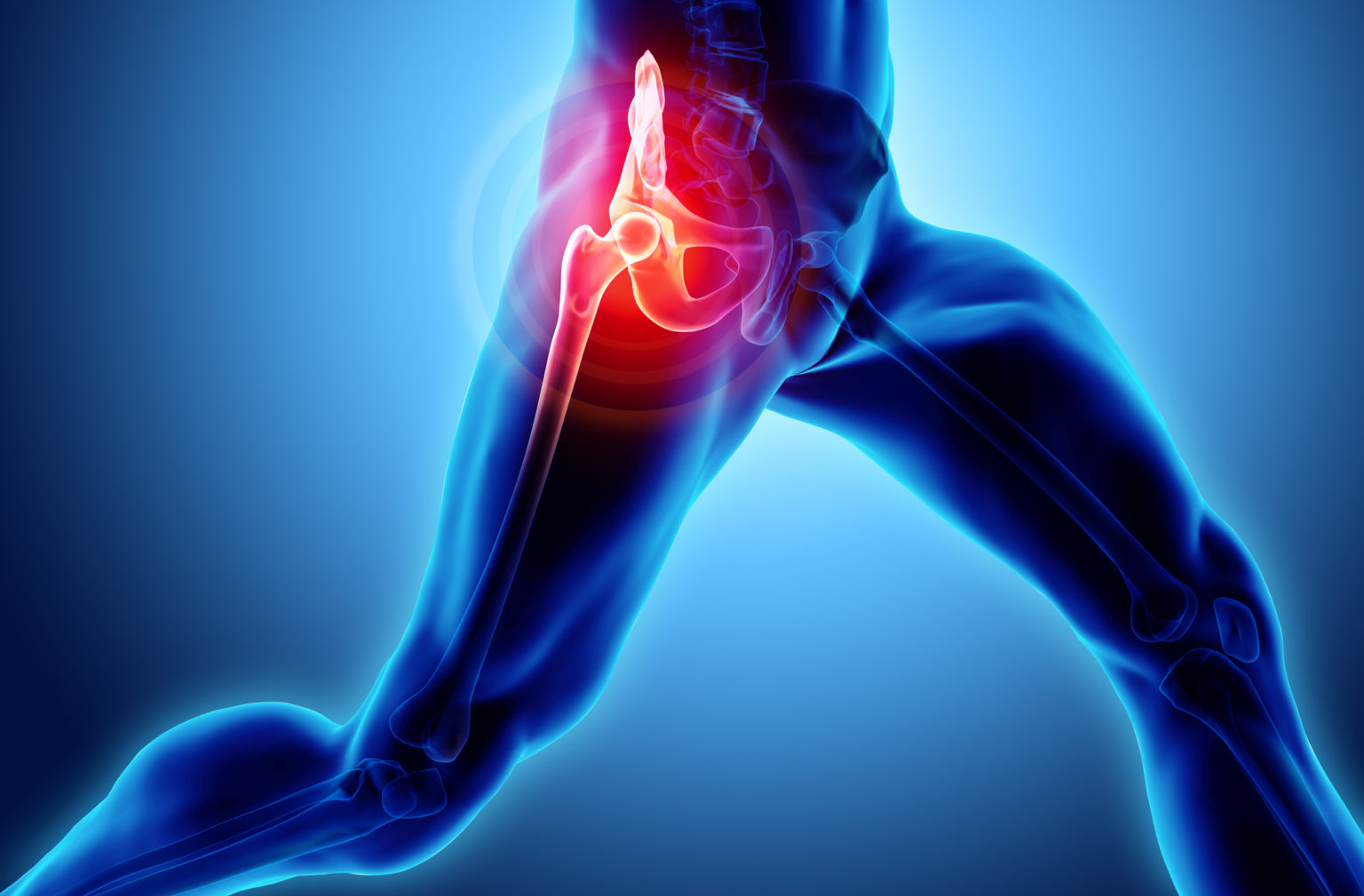 diagnosing-and-understanding-hip-pain-miosuperhealth