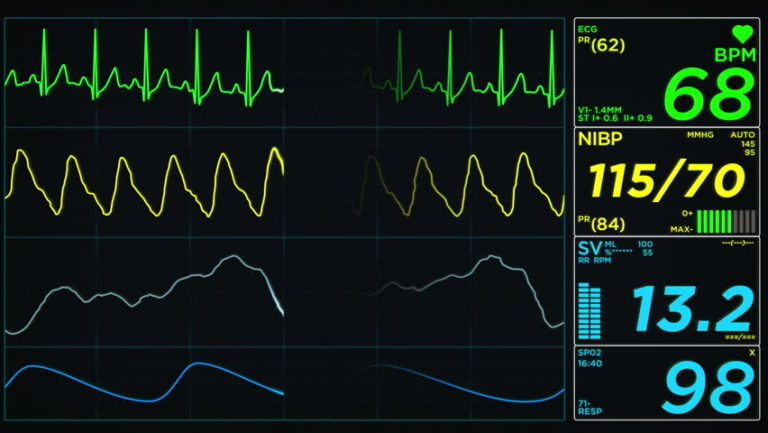 expert-s-answer-how-does-a-heart-rate-monitor-work-miosuperhealth