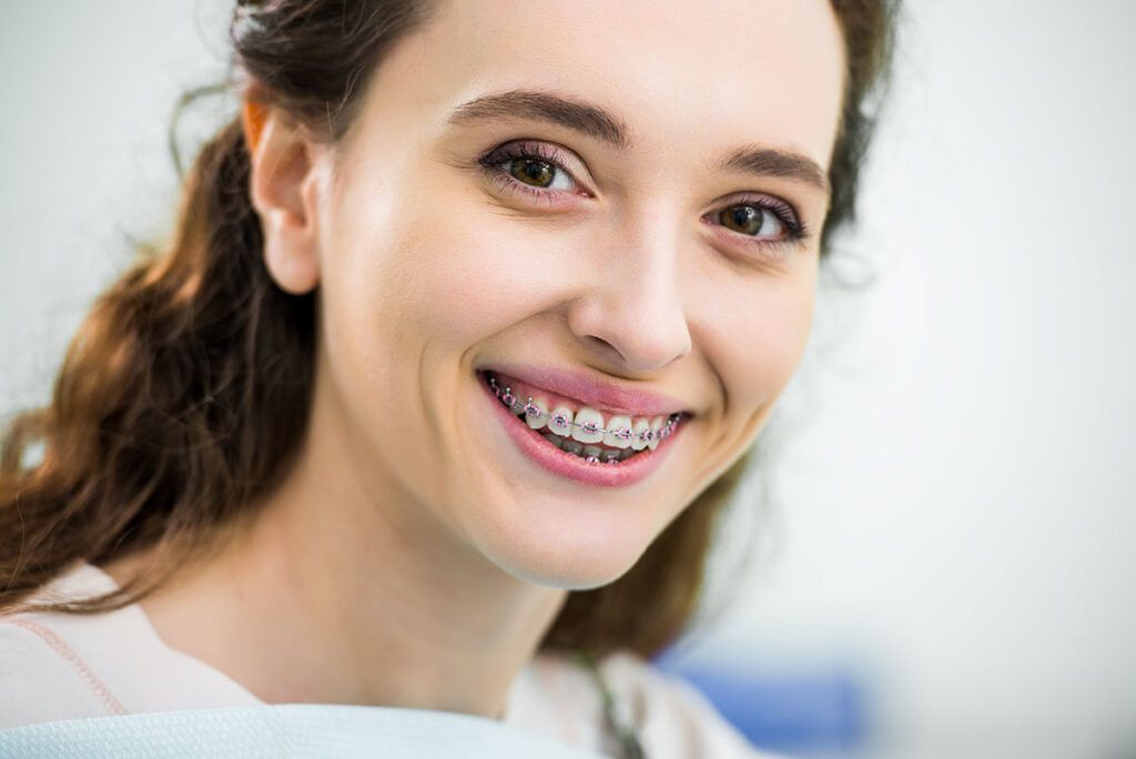 Things To Know When Getting Braces As An Adult Miosuperhealth